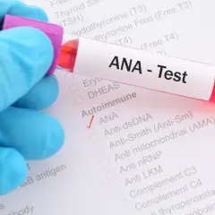 Badanie ANA - Test wykrywa przeciwciała przeciwjądrowe, kluczowe w diagnostyce chorób autoimmunologicznych.